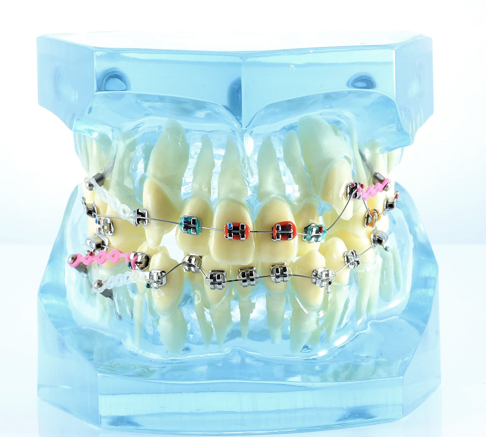 TIPODONTO CON MINI IMPLANTES AZUL 1 PIEZA