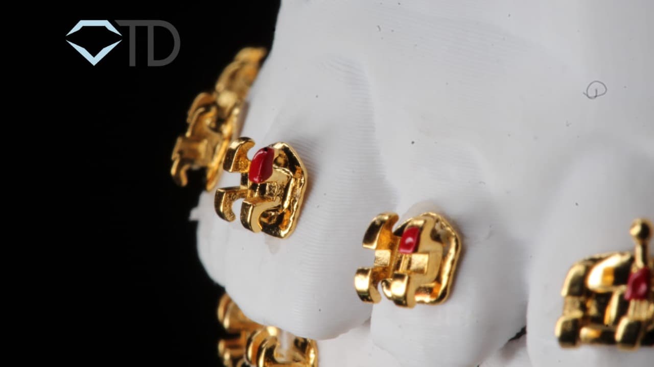 BRACKETS METALICOS DORADO ROTH .022 GANCHOS 3,4,5